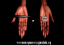 Contro le mutilazioni femminili