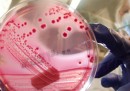 Tre morti da batteri E. coli in Germania