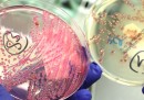 Cosa sappiamo delle infezioni da E. coli