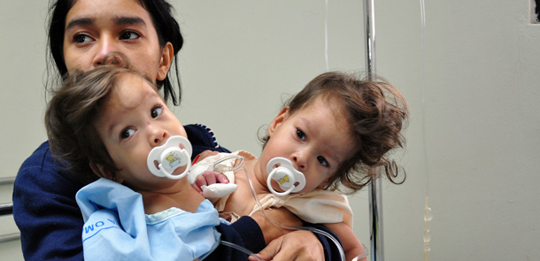 Sara Lizbeth Gil holds her siamese twin daughters Hannah Yineth (L) and Hannah Yaneth Fernandez Gil just before their operation on September 28, 2010 in Panama City. The year-old Siamese twin girls connected at the abdomen were surgically separated Tuesday by a team of 50 doctors from Panama and Argentina, in Panama's first medical operation of this kind. AFP PHOTO/POOL - Armando Acevedo (Photo credit should read ARMANDO ACEVEDO/AFP/Getty Images)
