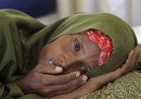 I bambini somali muoiono di fame