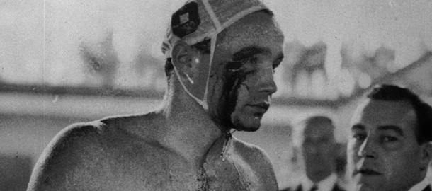 Blood streams from the cut eye of Hungarian Ervin Zador injured during a fight with a Russian in the closing stages of the Hungary vs. Russia water polo match in Melbourne, Australia December 6, 1965. (AP PHOTO)