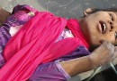 La donna trovata viva tra le macerie di Dacca