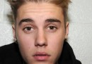 Justin Bieber, i video dell'arresto e il diritto alla privacy