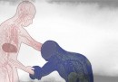Gli effetti di ebola sul corpo umano