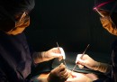 Le donne morte dopo la sterilizzazione in India