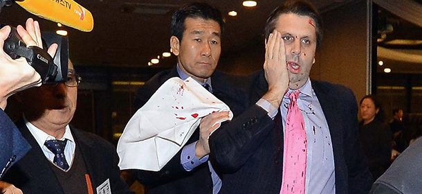 SEOUL, SOUTH KOREA - MARCH 05: (SOUTH KOREA OUT) In this handout image provided by The Asia Economy Daily newspaper, U.S. Ambassador to South Korea Mark Lippert is seen after getting attacked on March 5, 2015 in Seoul, South Korea. Ambassador Lippert was attacked with a razor blade by a man at a venue where he was going to give a lecture. The attacker who reportedly identified himself as a representative for a watchdog organization of the disputed island Dokdo/Takeshima, was arrested immediately on site. (Photo by Handout/The Asia Economy Daily via Getty Images)