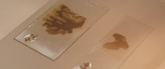 Due vetrini contenenti due strati laminari di tessuto cerebrale di Albert Einstein, esposti durante la mostra "Brains -The Mind as Matter" al museo Wellcome Collection di Londra, il 27 marzo 2012. 
(AP Photo/Alastair Grant)