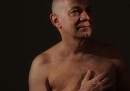Il tumore al seno degli uomini