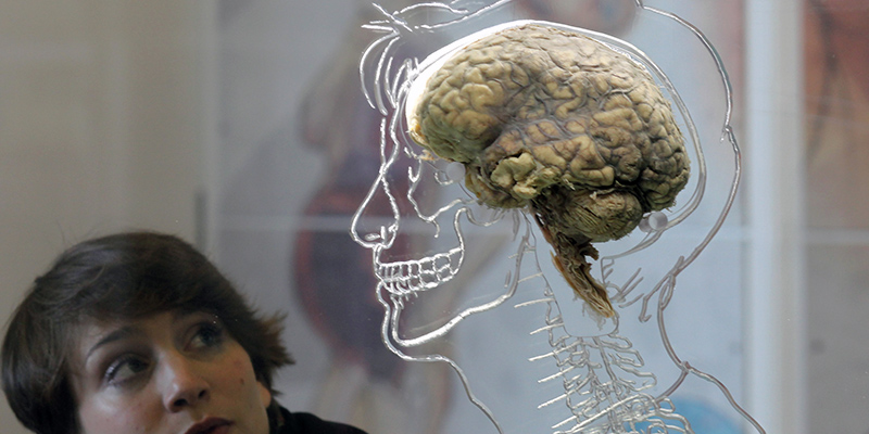 Un cervello umano esposto a una mostra organizzata nel 2011 a Bristol, Regno Unito (Matt Cardy/Getty Images)