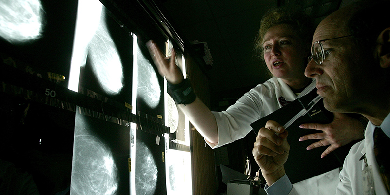 C'è una nuova terapia per il cancro al seno?