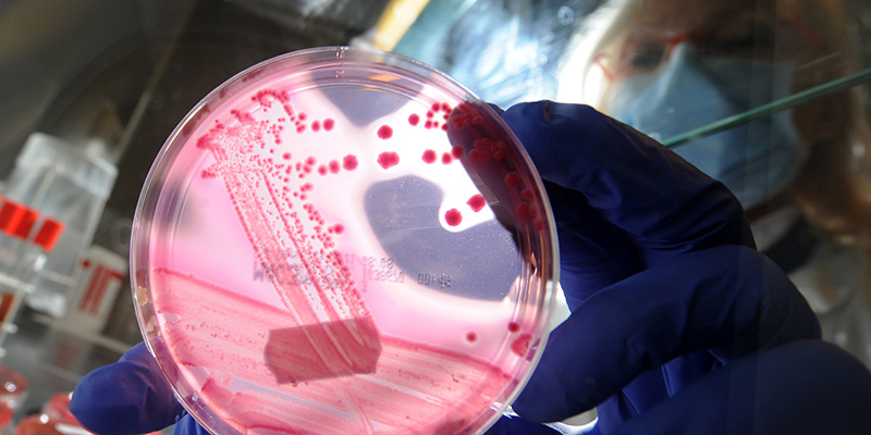 Una coltura di E. coli in laboratorio (CHRISTIAN CHARISIUS/AFP/Getty Images)