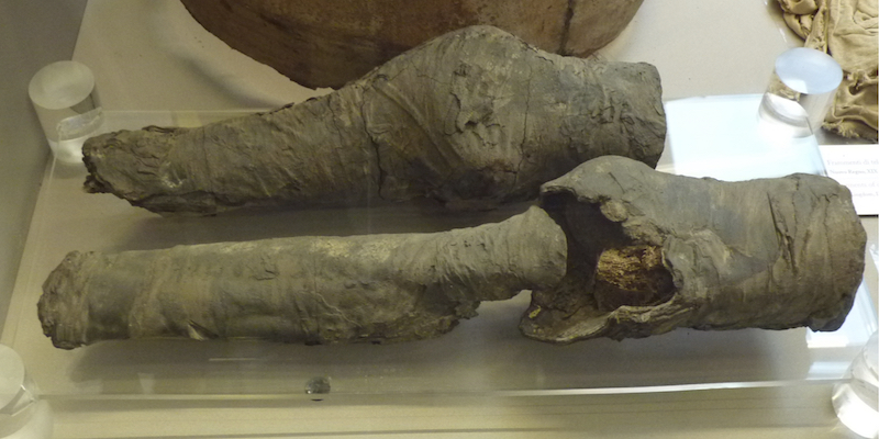 Ginocchia mummificate conservate al Museo Egizio di Torino che si pensa fossero della regina Nefertari (PLOS ONE)