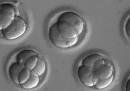 Il gene di una malattia mortale è stato rimosso da embrioni umani per la prima volta