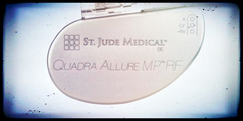 (St Jude Medical - Abbott Laboratories)