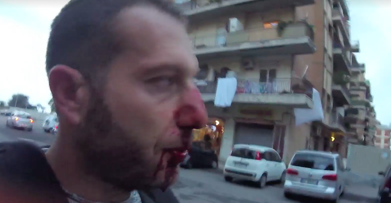 Daniele Piervincenzi con il naso sanguinante dopo essere stato aggredito (Rai)