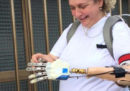 Come fa una mano bionica a 