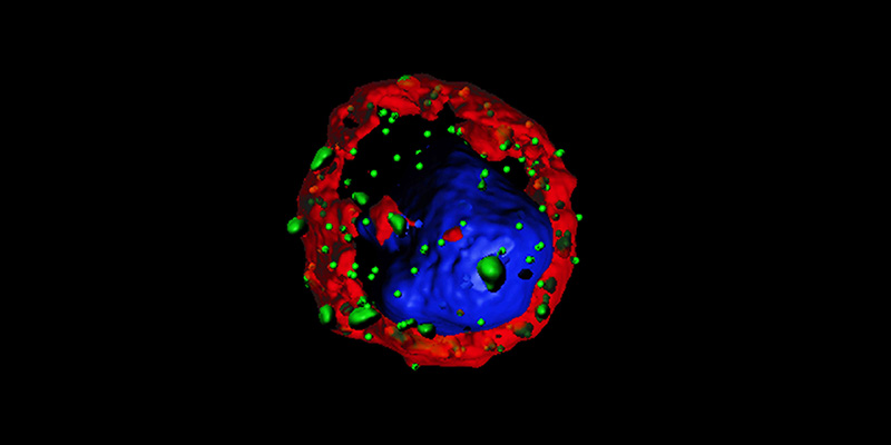 Una cellula (linfocita) T modificata attraverso un recettore chimerico antigenico (Chimeric Antigen Receptor, CAR, a destra) reso evidente con la tecnica dell'immunofluorescenza: il recettore CAR è visualizzato in verde, la membrana cellulare in rosso e il nucleo in blu (Bambino Gesù)