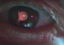 Una nuova intelligenza artificiale di Google prevede il rischio cardiovascolare guardandoti negli occhi