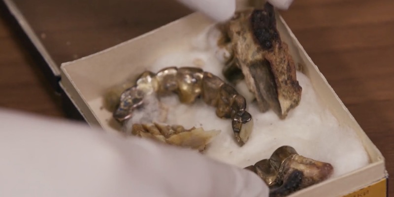 I presunti denti di Hitler conservati a Mosca, negli archivi di stato ("Le mystère de la mort d’Hitler")