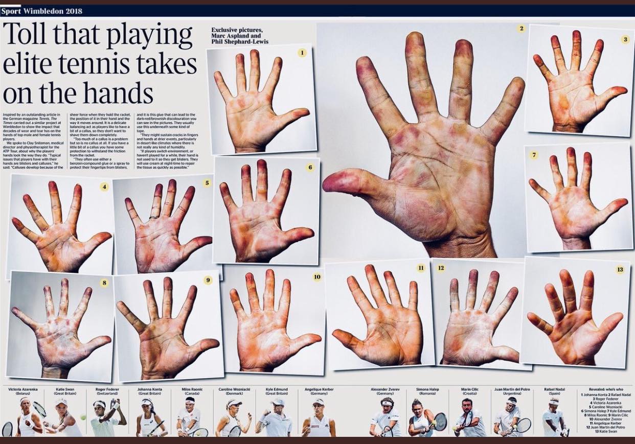 Come sono ridotte le mani dei tennisti a Wimbledon