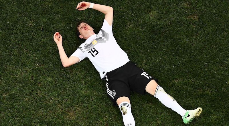 Il centrocampista della Germania Sebastian Rudy dopo un infortunio contro la Svezia, 23 giugno
(JEWEL SAMAD/AFP/Getty Images)