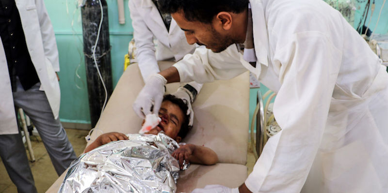 Un bambino ferito nel bombardamento circondato da tre medici in un ospedale della provincia di Saada (STRINGER/AFP/Getty Images)