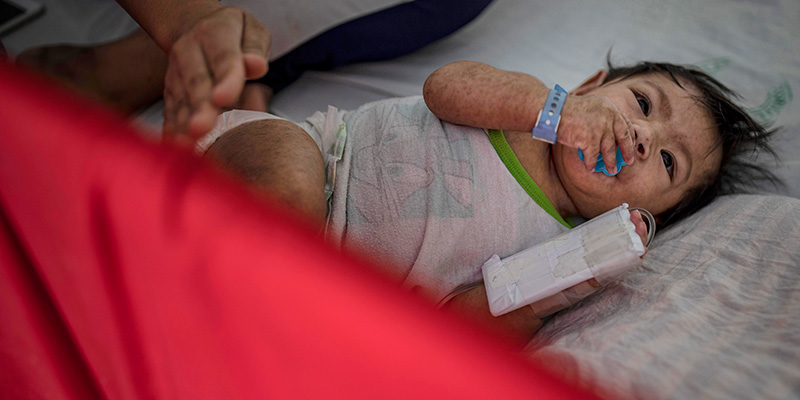 Un bambino malato di morbillo assistito in un ospedale di Manila, Filippine (Ezra Acayan/Getty Images)