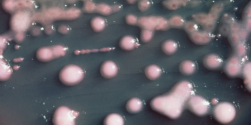 Una colonia del batterio Klebsiella pneumoniae in una piastra di Petri nel 1976 (APImages -/CDC/dapd)