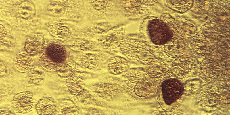 Batteri di Chlamydia trachomatis in un'immagine al microscopio del 1975 (Dr. E. Arum, Dr. N. Jacobs/CDC via AP, File)
