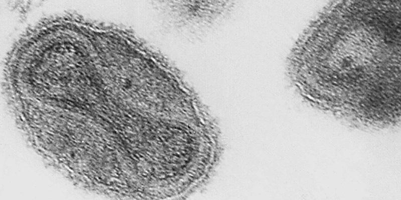Il virus del vaiolo, 1975 (Getty Images)