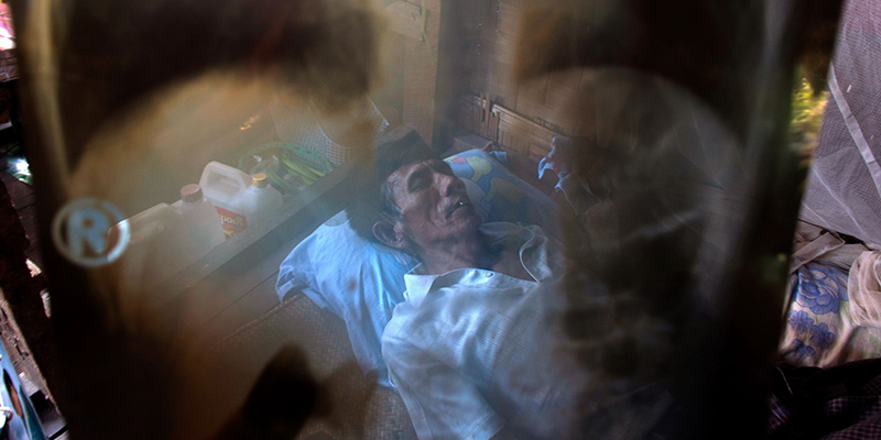 Un paziente affetto da tubercolosi a Yangon, Myanmar (CKN/Getty Images)