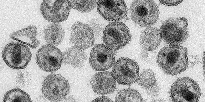 Virioni di HIBV fotografati con un microscopio elettronico nel 2011 (Maureen Metcalfe, Tom Hodge/CDC via AP)