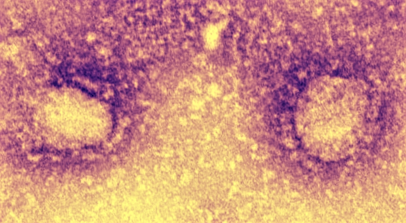 Due virioni del nuovo coronavirus al microscopio elettronico (Centro Dati Nazionale di Microbiologia, Cina)