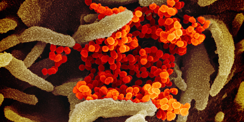 Il nuovo coronavirus (arancione) al microscopio elettronico (NIAID-RML via AP)