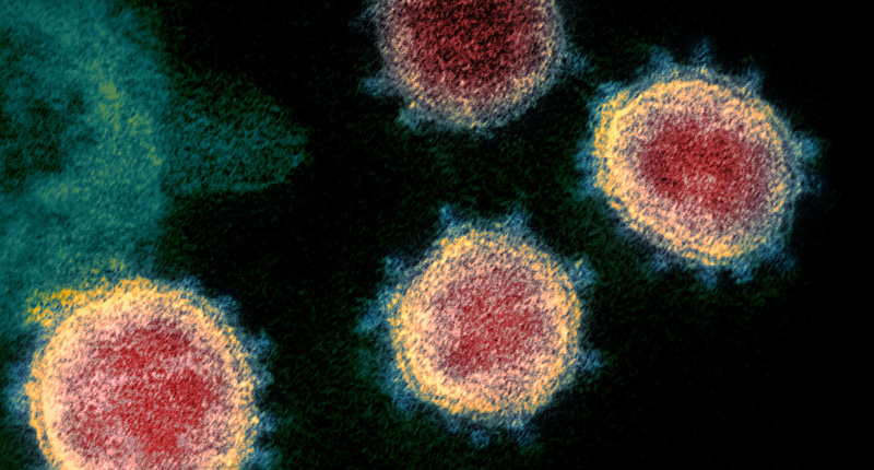 Il coronavirus SARS-CoV-2 al microscopio elettronico (NIAID Rocky Mountain Laboratories RML, U.S. NIH)