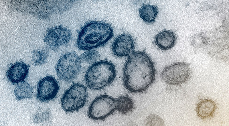 Il coronavirus SARS-CoV-2 al microscopio elettronico (NIAID Rocky Mountain Laboratories, RML, U.S. NIH)