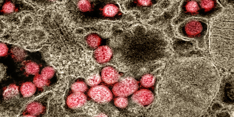 Particelle virali del SARS-CoV-2 al microscopio elettronico (NIAID)