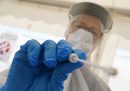 Un gruppo di ricercatori di Hong Kong ha confermato un caso di seconda infezione da coronavirus nella stessa persona