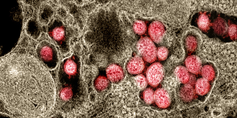 Coronavirus, in rosso, tra i tessuti cellulari, osservati al microscopio elettronico (NIAID)