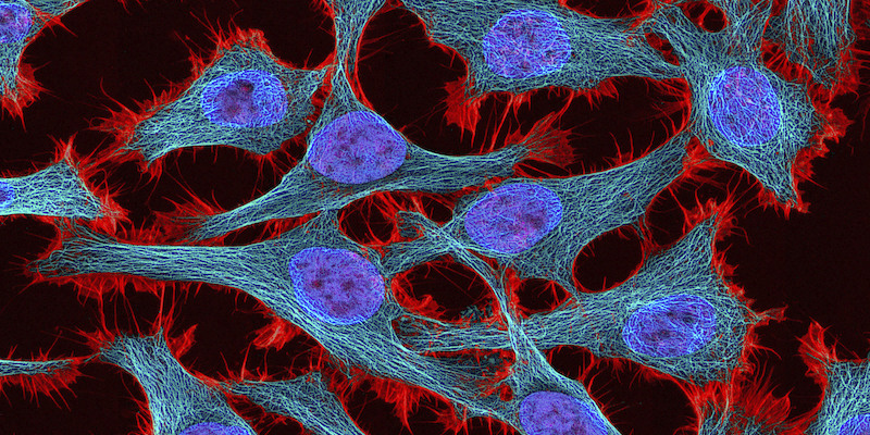 Cellule HeLa fotografate con una tecnica di microscopia a fluorescenza: i nuclei delle cellule sono quelli blu, in azzurro invece sono i microtubuli che le uniscono (La Presse/National Center for Microscopy and Imaging Research via AP)