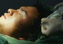 L'enorme successo della chirurgia estetica in Cina