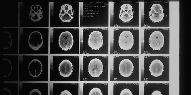 Le immagini ottenute da una TAC al cervello (Unsplash/National Cancer Institute)