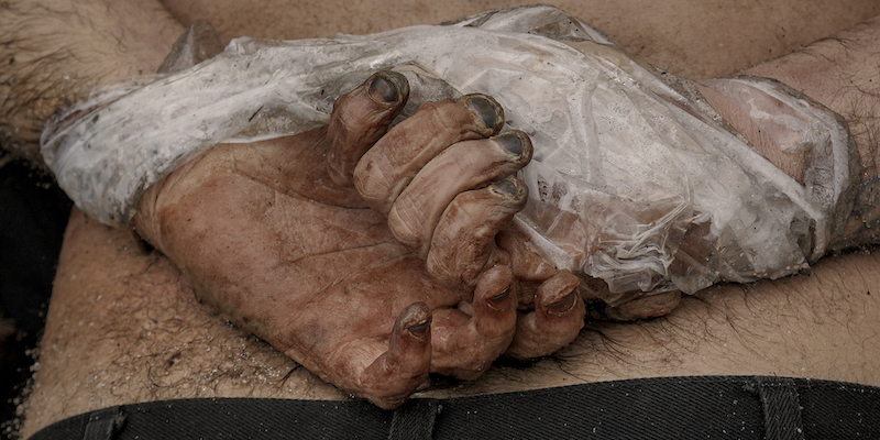 Le mani di un cadavere legate dietro alla schiena con del nastro adesivo. Bucha, Ucraina, 3 aprile 
(AP Photo/ Vadim Ghirda)