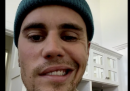Il video di Justin Bieber che mostra una paresi facciale