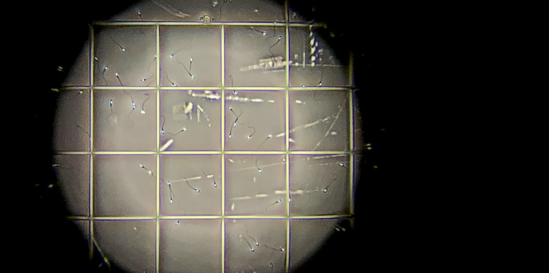 Un campione di sperma in un laboratorio australiano (AP Photo/Wong Maye-E)