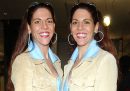 Le sorelle che hanno monopolizzato il business dei gemelli negli Stati Uniti