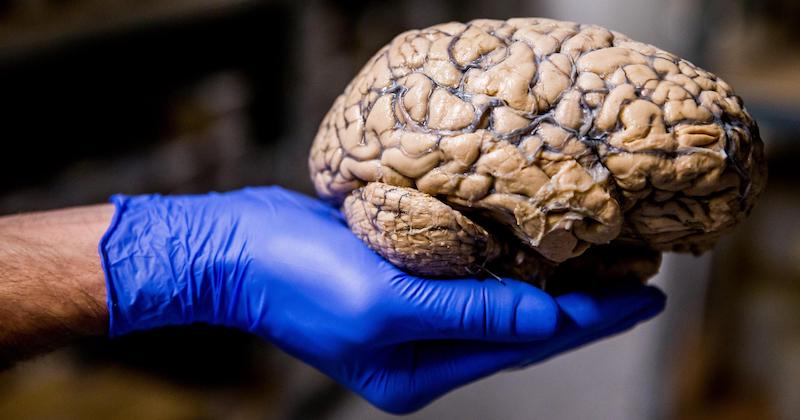 Un ricercatore mostra un cervello umano all'ospedale psichiatrico di Duffel, in Belgio