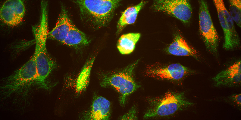 Cellule HeLa osservate al microscopio a fluorescenza. In blu i nuclei, in rosso le proteine di membrana e in verde le componenti del citoscheletro. GerryShaw,
7 agosto 2012 (via Wikimedia)