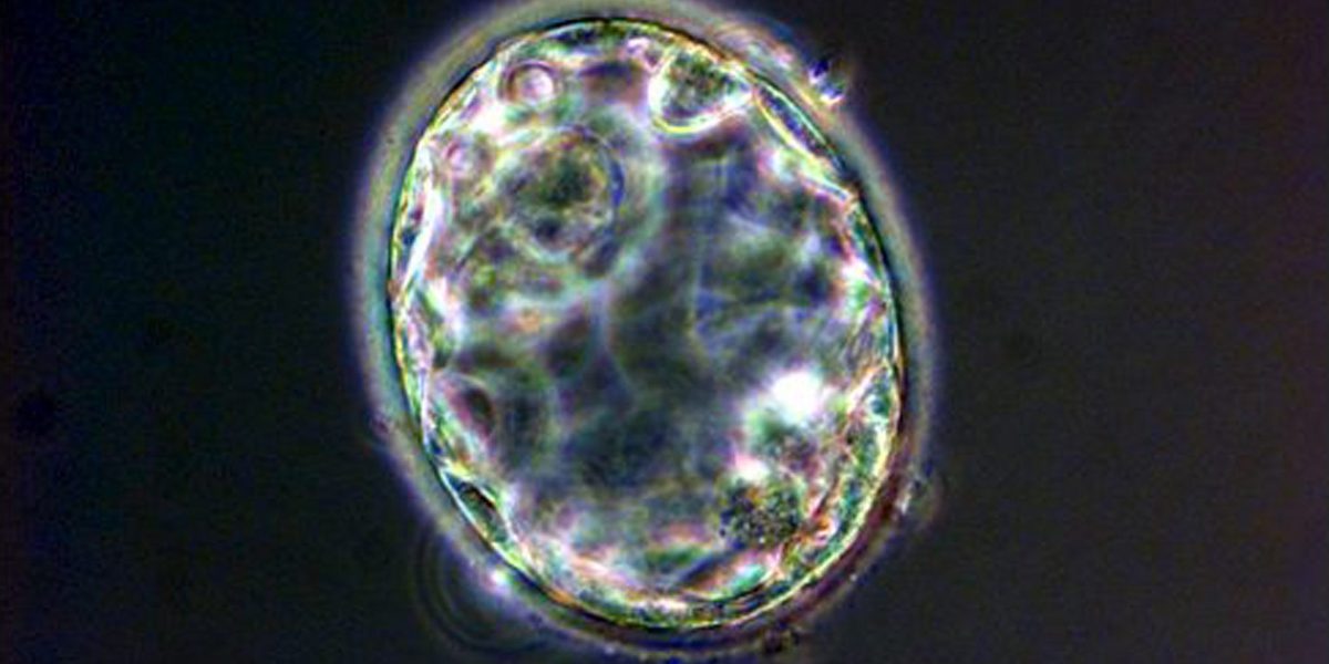Un embrione umano visto al microscopio (ANSA - ARCHIVIO)